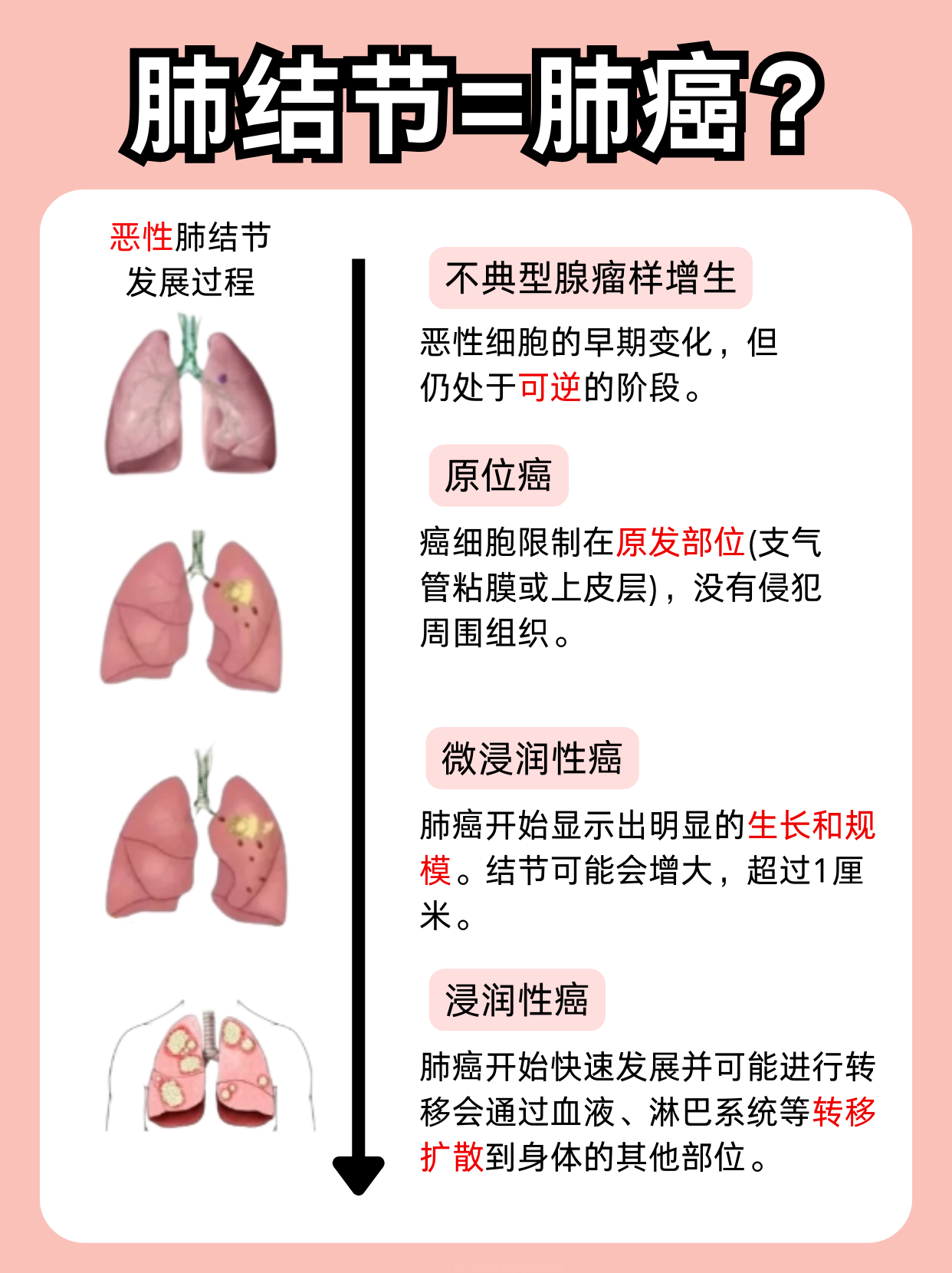 今天广州中医药大学金沙洲肿瘤医院张涵英医师就从医学角度拆解肺癌和肺肿瘤两者的核心差异