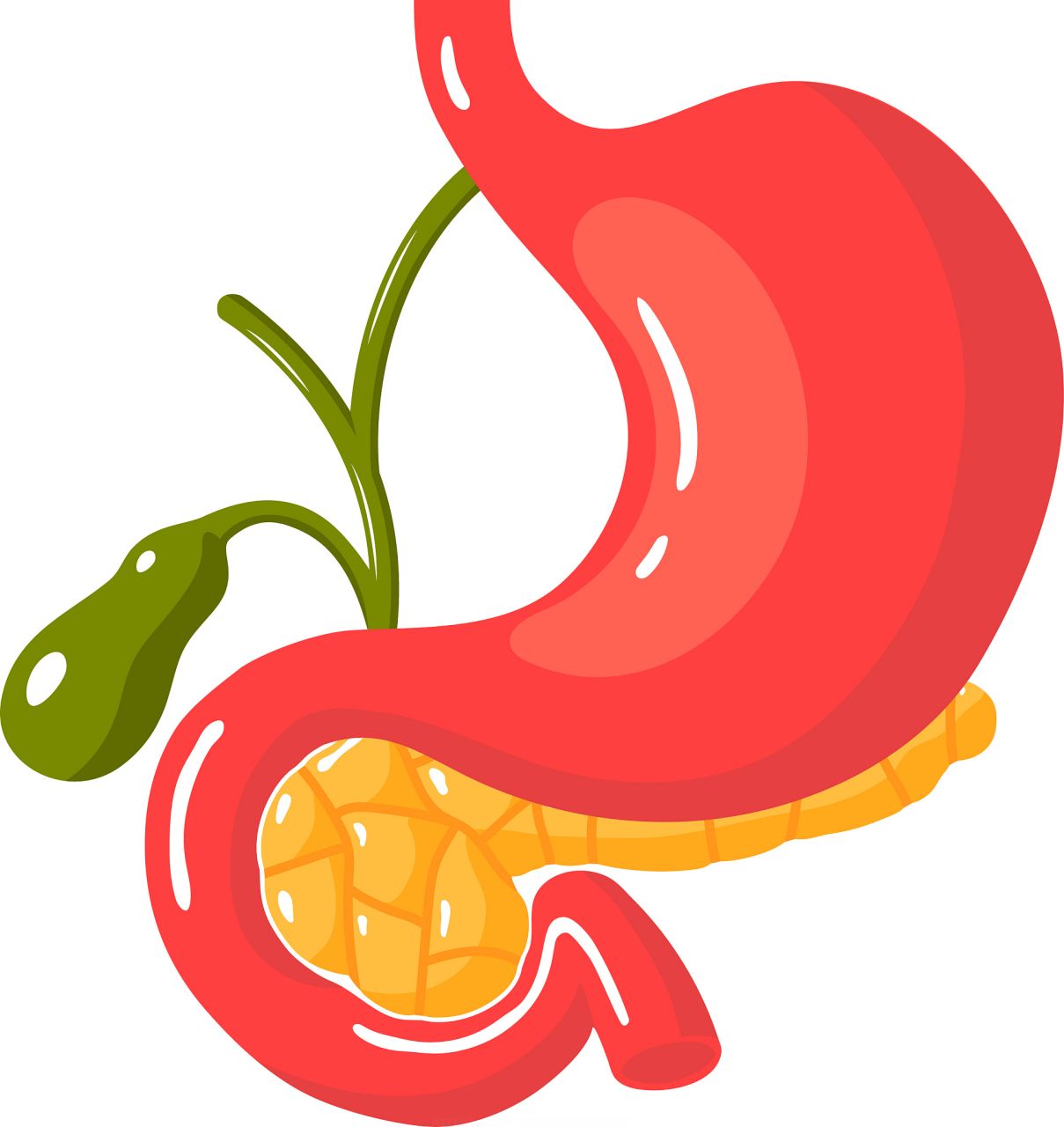 李坤医生提醒：小心胰腺癌的 “隐形推手”，这些诱因你必须知道！